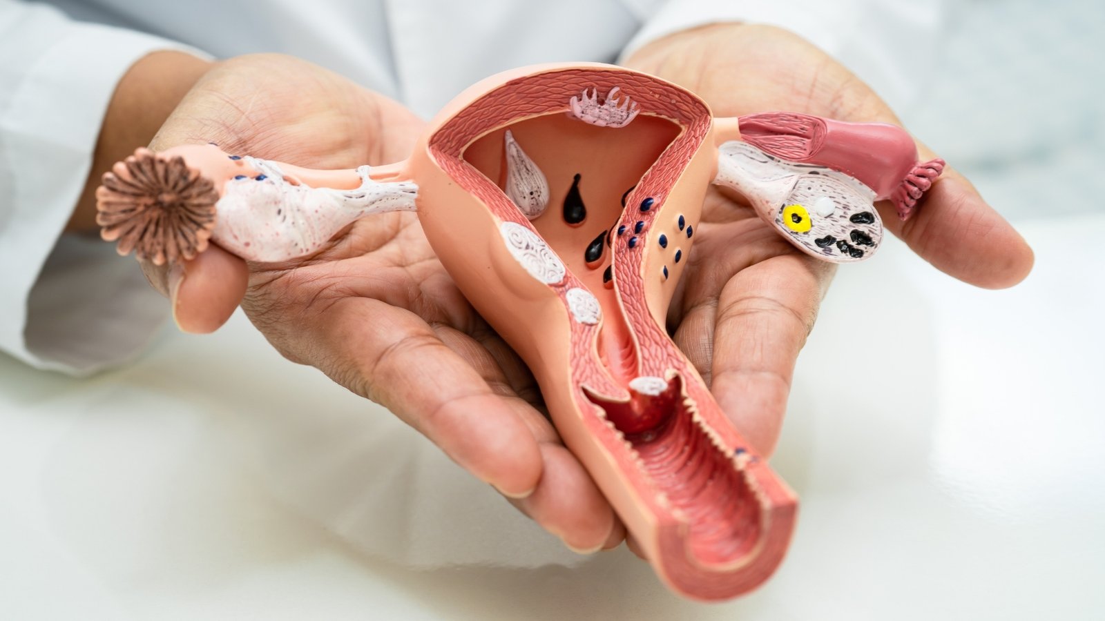 endometrium