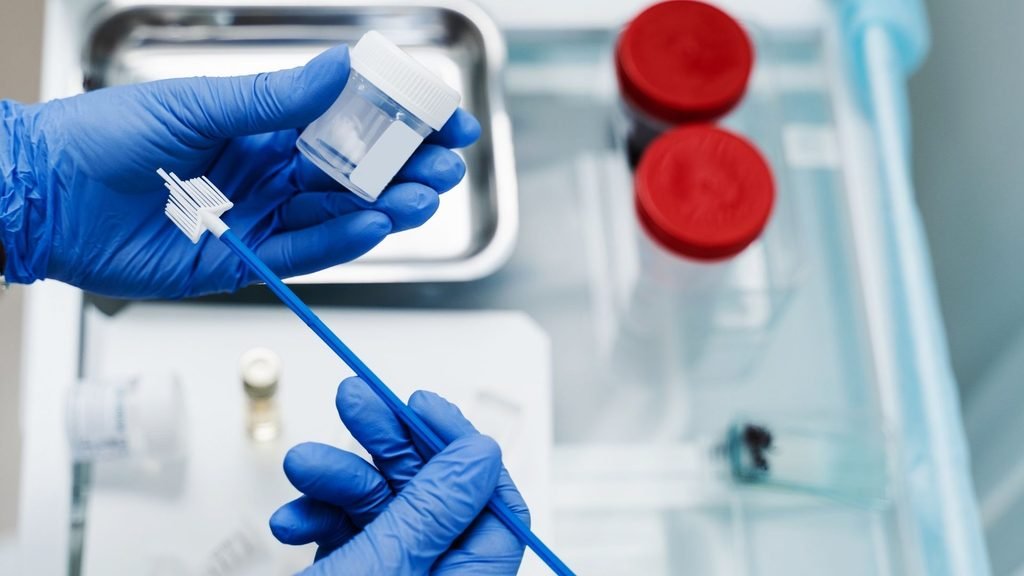 Pap Smear Testi Kaç Yılda Bir Yapılmalı ve HPV Testi ile Arasındaki Fark Nedir?